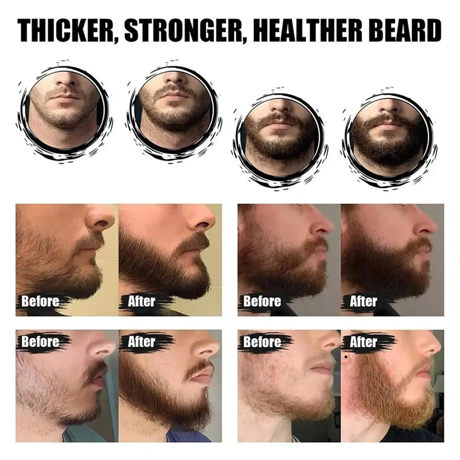 High Quality Fast Beard Growth Serum For Men Promote Beard Regrowth Thicker Longer Fuller Anti Hair Loss Essential Oil Hair Care
