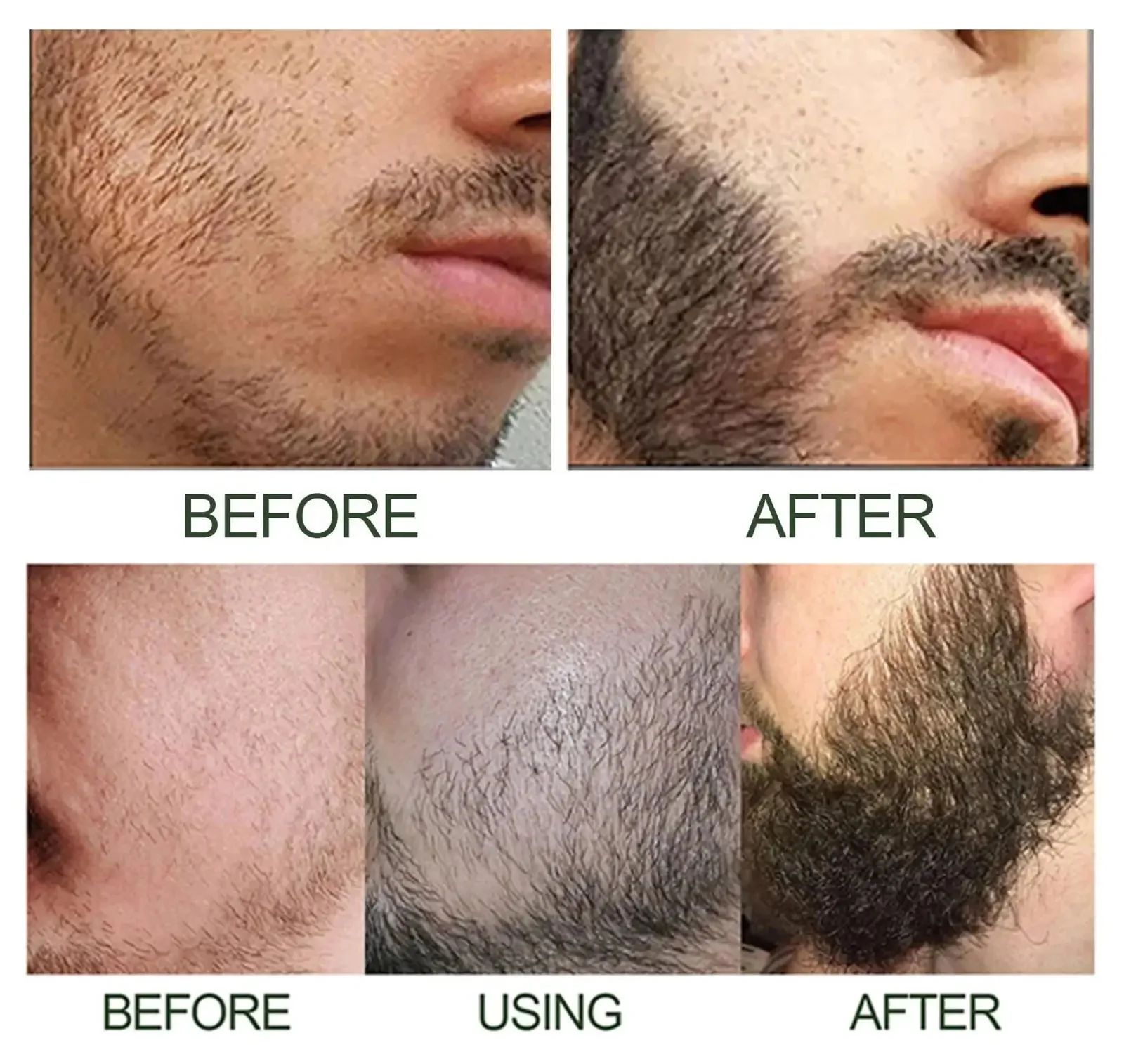 High Quality Fast Beard Growth Serum For Men Promote Beard Regrowth Thicker Longer Fuller Anti Hair Loss Essential Oil Hair Care