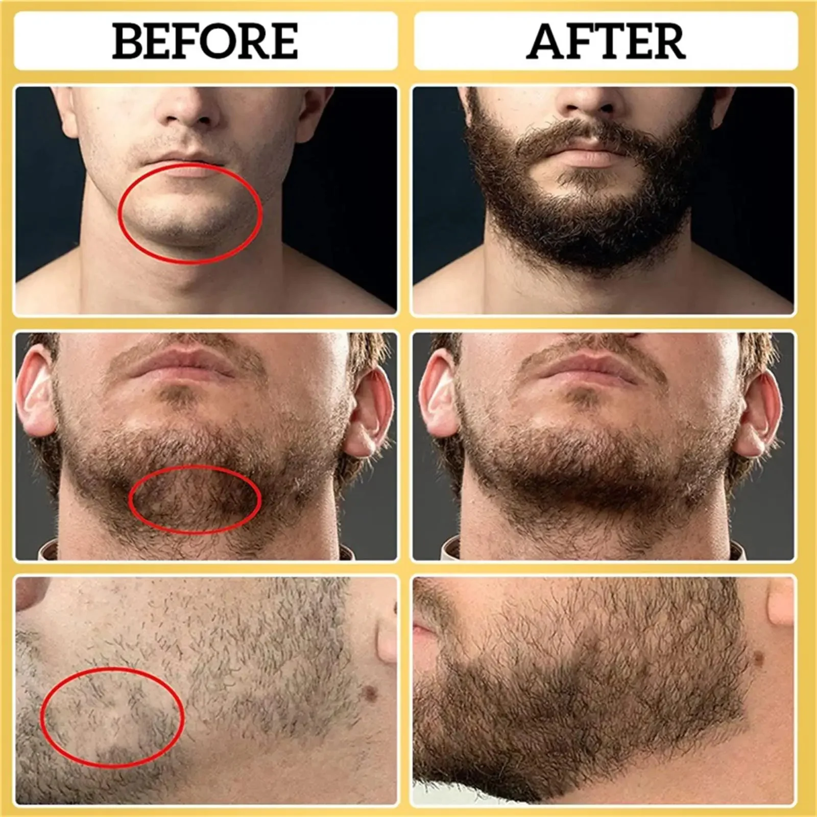 High Quality Fast Beard Growth Serum For Men Promote Beard Regrowth Thicker Longer Fuller Anti Hair Loss Essential Oil Hair Care