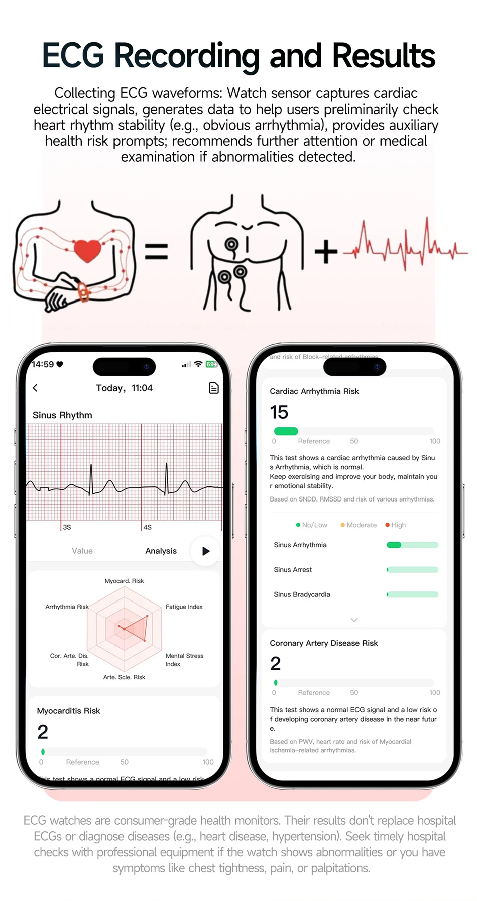 New Men Accurate Health Diagnosis ECG Smart Watch Blood Pressure Blood Oxygen Blood Fat Uric Acid Temp Bluetooth call Smartwatch