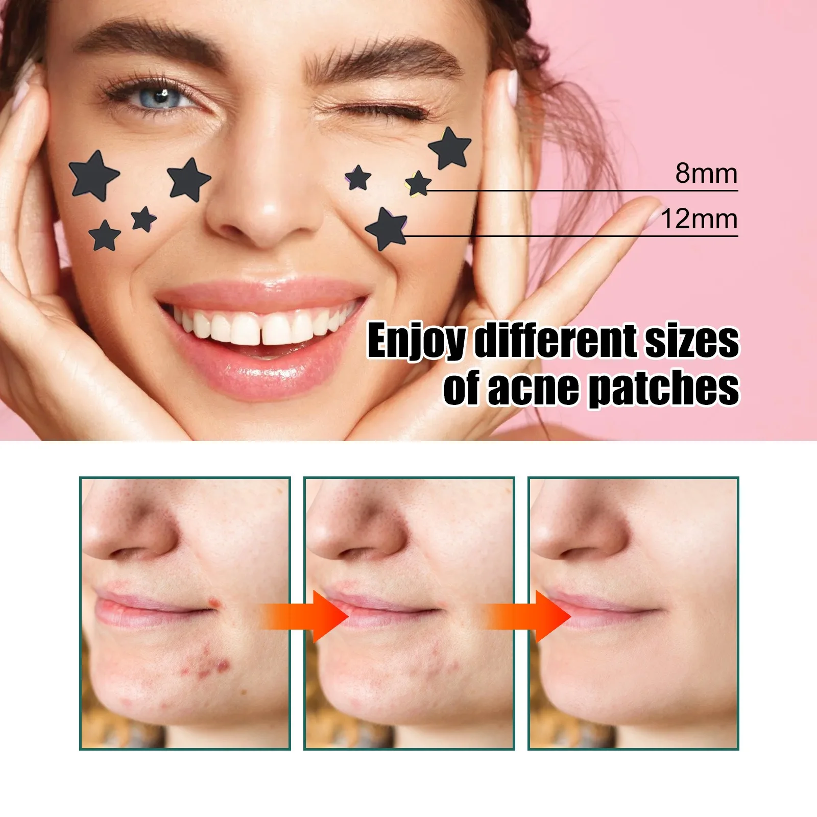 Summer Gradient Palm Packaging Star Acne Patches 480PCS Sweatproof Colorful Decorative Face Zit Stickers For All Skin Types