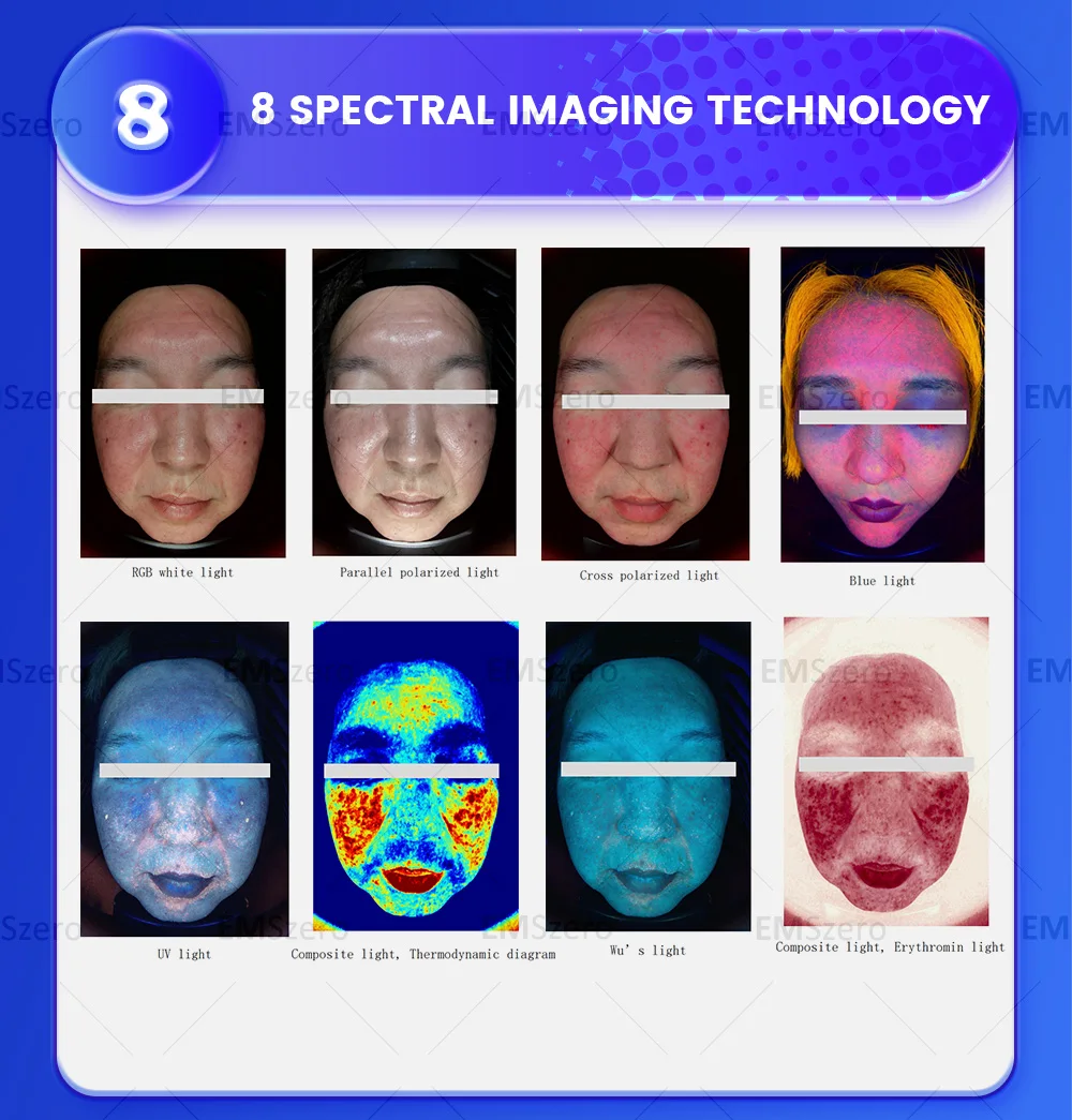 AISA Q1 Skin Analyzer X5 3D Professional Facial Skin Analyzer Machine O1 Pro AI Skin Analysis Scanner 15.6inch 10 Light Spectrum AISA Q1 Skin Analyzer X5 3D Professional Facial Skin Analyzer Machine O1 Pro AI Skin Analysis Scanner 15.6inch 10 Light Spectrum