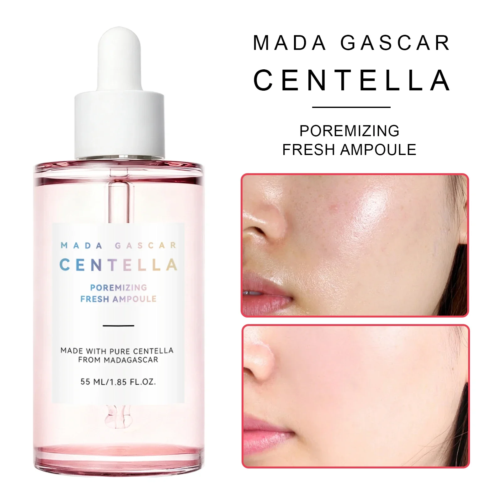 Brightening Centella Niacinamide Serum 55ml - Hydrating Ampoule Soothes Uneven Skin Tone & Boosts Radiance for a Clear Glow.