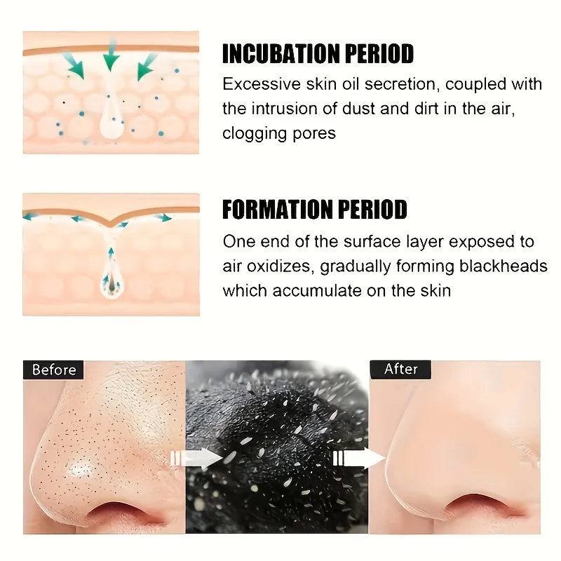 Alcohol-Free Nose Cleaning Strips – Deep Cleansing Pore Patches for Excess Oil Removal Refined Skin, Mild Fragrance-Free