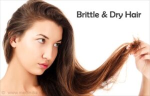 Overcoming Dry and Brittle Hair
