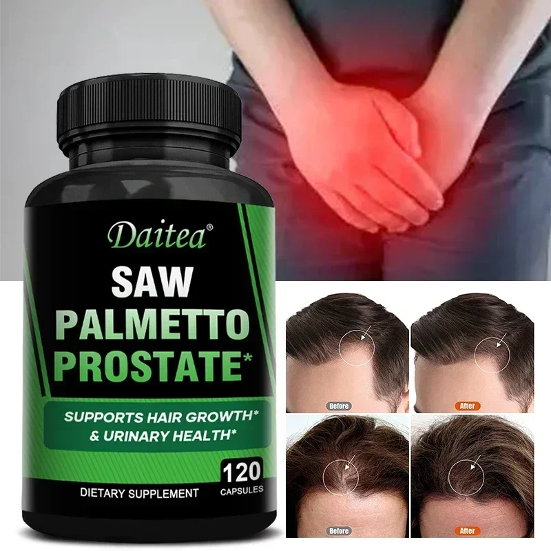 Saw Palmetto Capsules Help Promote Prostate Health,Reduce Baldness and Thinning Hair &Regulate Hormonal Sex Capsules in The Body Smart Shop Smart Supplements