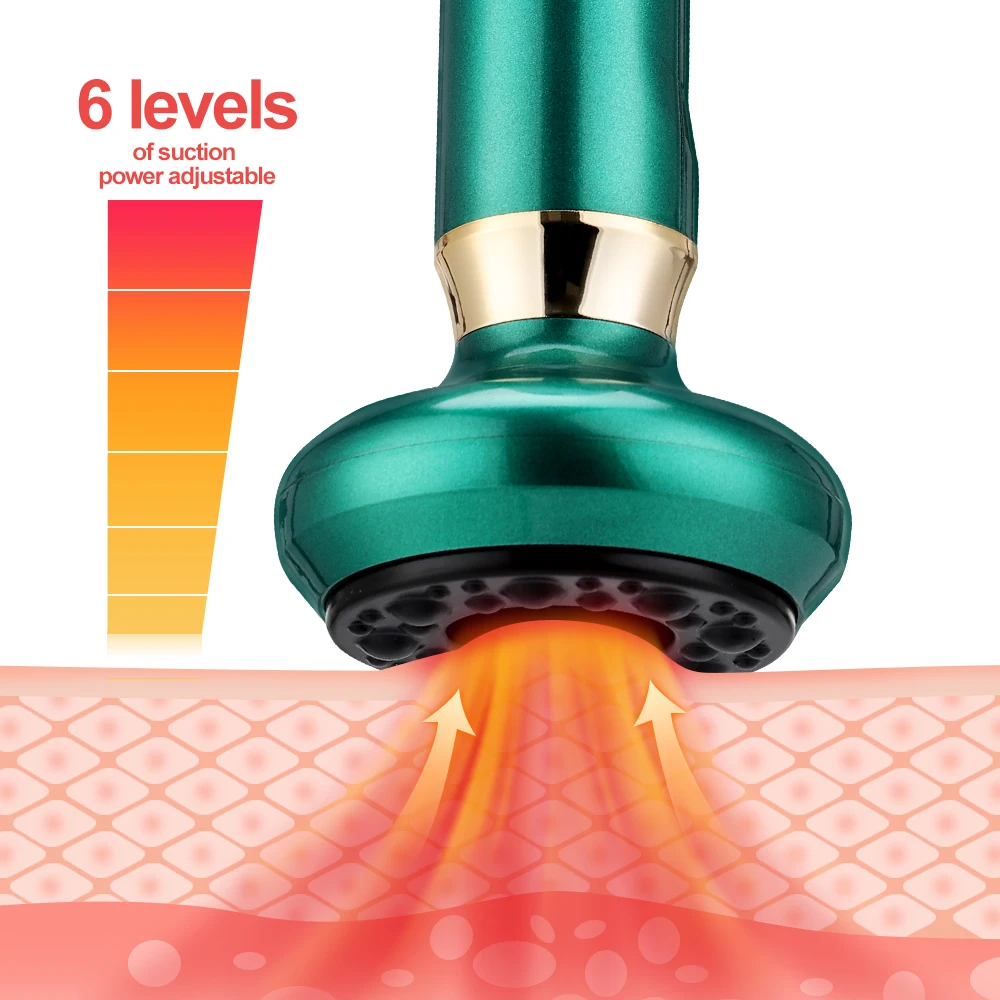 Rechargeable Electric Cupping Massager Vacuum Suction with Infrared Heat GuaSha Anti Cellulite Slimming for Body Back Leg