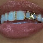 2pcs Set Stainless Steel Dental Grills
